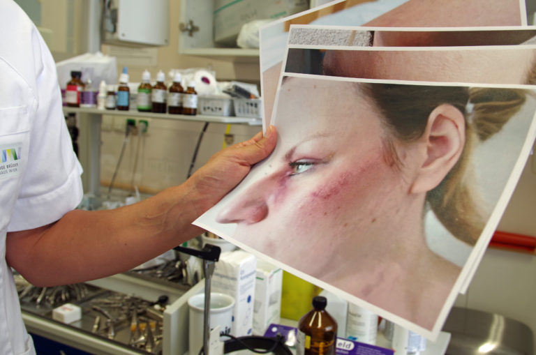 Hinsehen und handeln: „plan b“ im ZDF über häusliche Gewalt